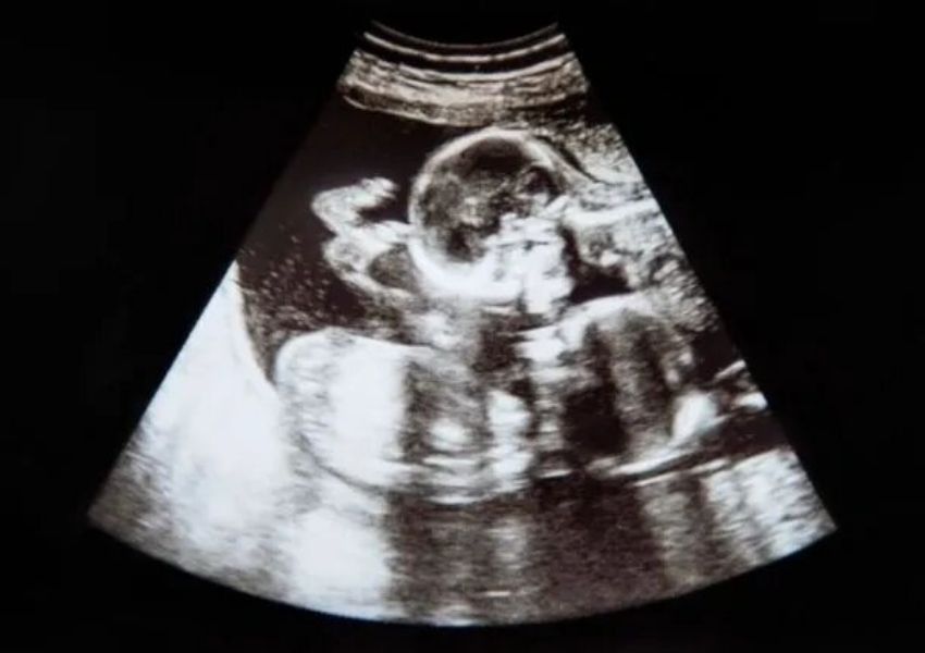 image ultrasound